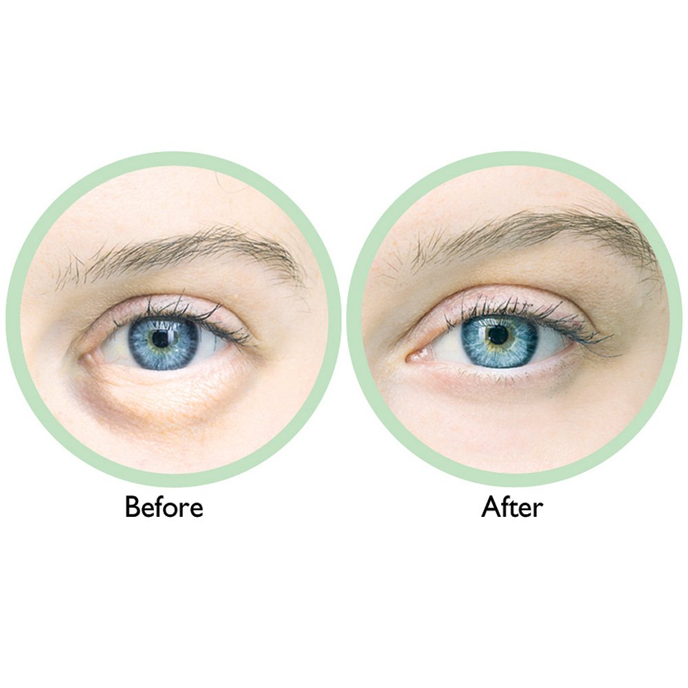 Barielle Puffy Eye Relief (2-PACK)